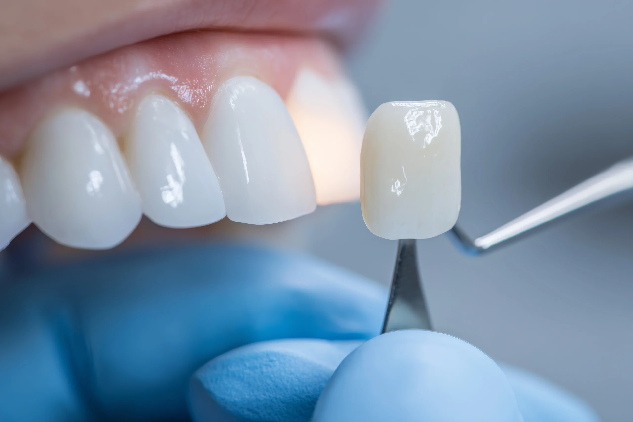 Cosmetic dentist working with a patient at Pro Solutions Dental Group in Prescott, AZ.